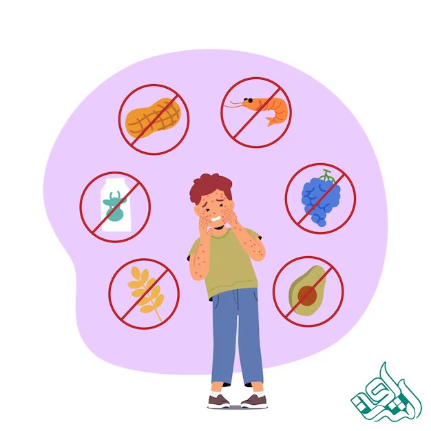 آلرژی